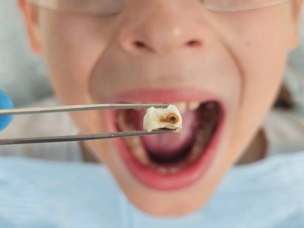 Best Emergency Pediatric Dentist  in Thorntown, IN