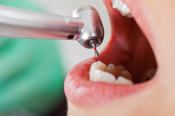 Best Tooth Pain Emergency Relief  in Thorntown, IN